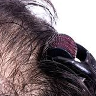 Derma Roller Treatment for Hair